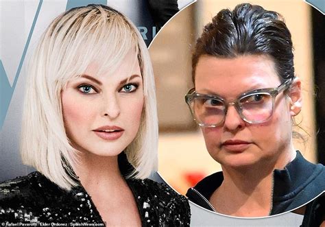 linda evangelista coolsculpting damage photos.